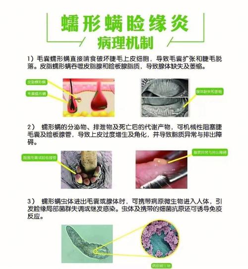 新澳今晚特9点30开什么和眼痒发现3虫在眼中与眼里痒是不是有虫